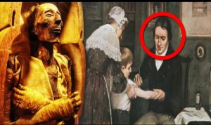 فيروس الجدري في مومياء رمسيس الخامس